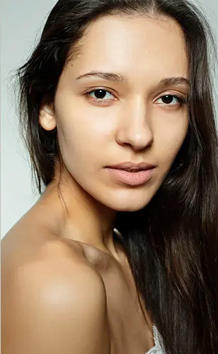 Gözaltı Işık Dolgusu Öncesi Sonrası